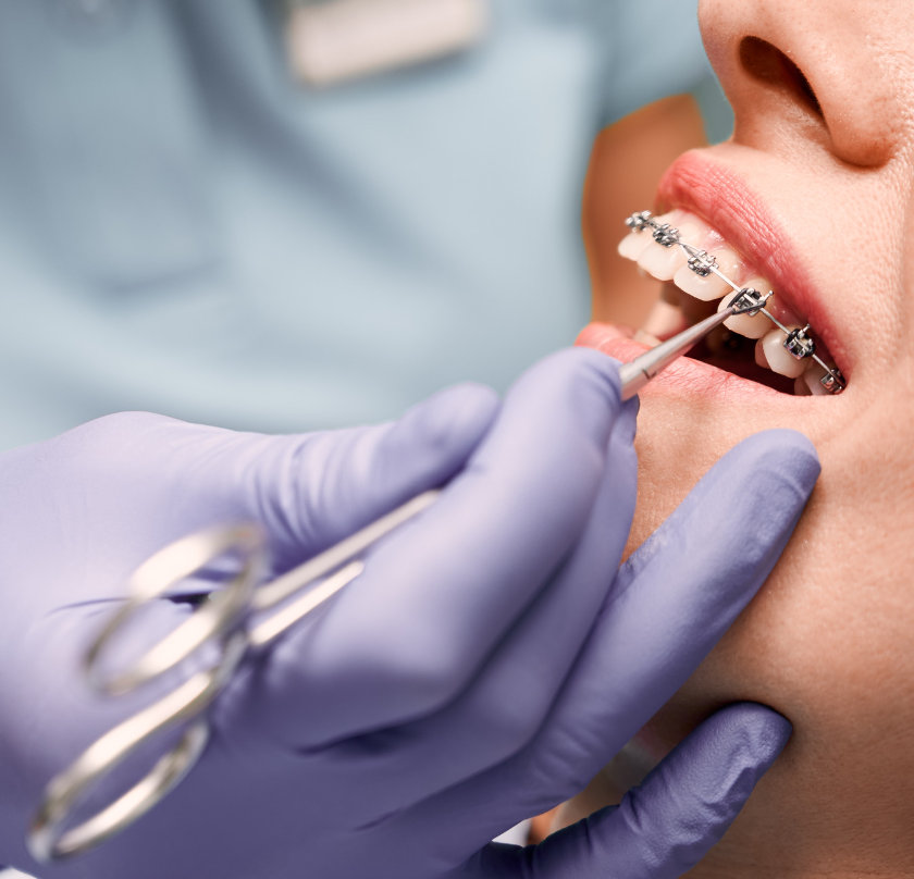 การจัดฟัน (Orthodontics)